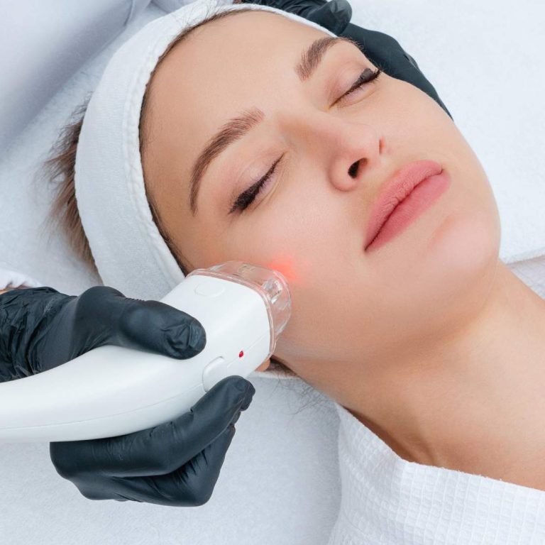 laser-skin-rejuvenation-treatment